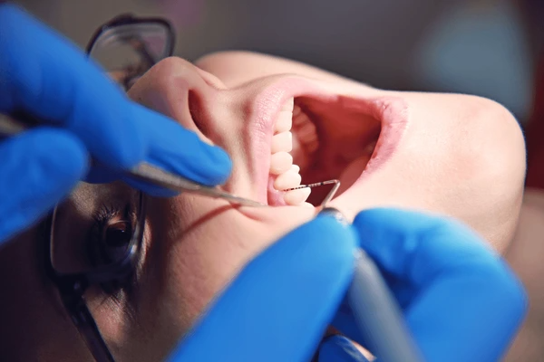 Dentist carefully examining a patient’s mini dental implants during a routine check-up at CDIC Islamabad.